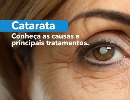 Catarata – Doença ocular que pode levar a cegueira
