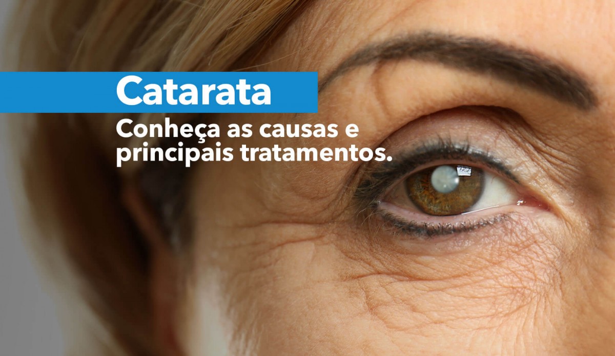 Catarata – Doença ocular que pode levar a cegueira - Hospital Santa ...