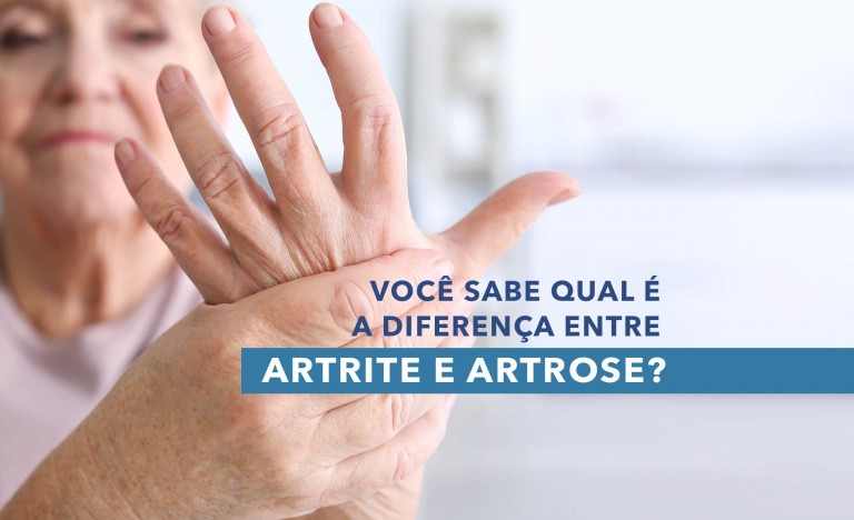 Artrite x Artrose - Saiba a diferença entre as doenças, seus sintomas ...