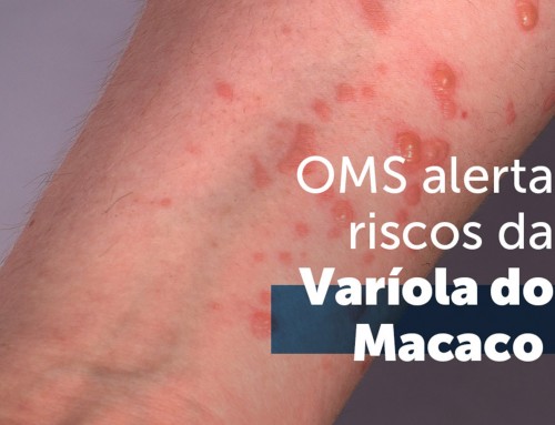Monkeypox: Porque devemos tomar cuidado com a Varíola do Macaco